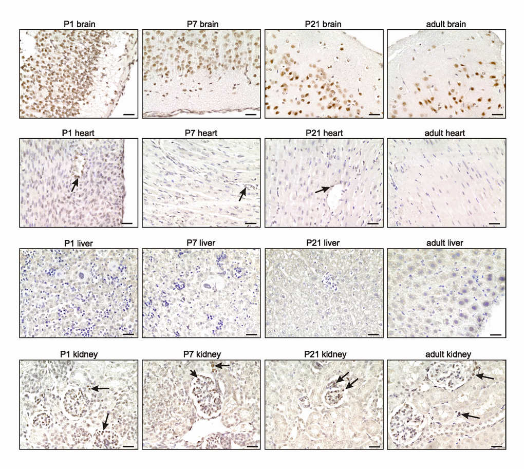 TRF2 expression remains high in the brain during adulthood. Representative photomicrographs of TRF2 immunostaining for the brain, heart, liver, and kidney (3,3' diaminobenzidine (DAB) substrate, brown, hematoxylin counterstaining) at different stages after birth. Note the persistent high expression of TRF2 in neurons of the brain (see also Supplementary Figure S1), the specific expression in subepicardial endothelial cells of the heart, and glomerular podocytes and juxta-glomerular cells of the kidney (arrows). Scale bars indicate 50µm.