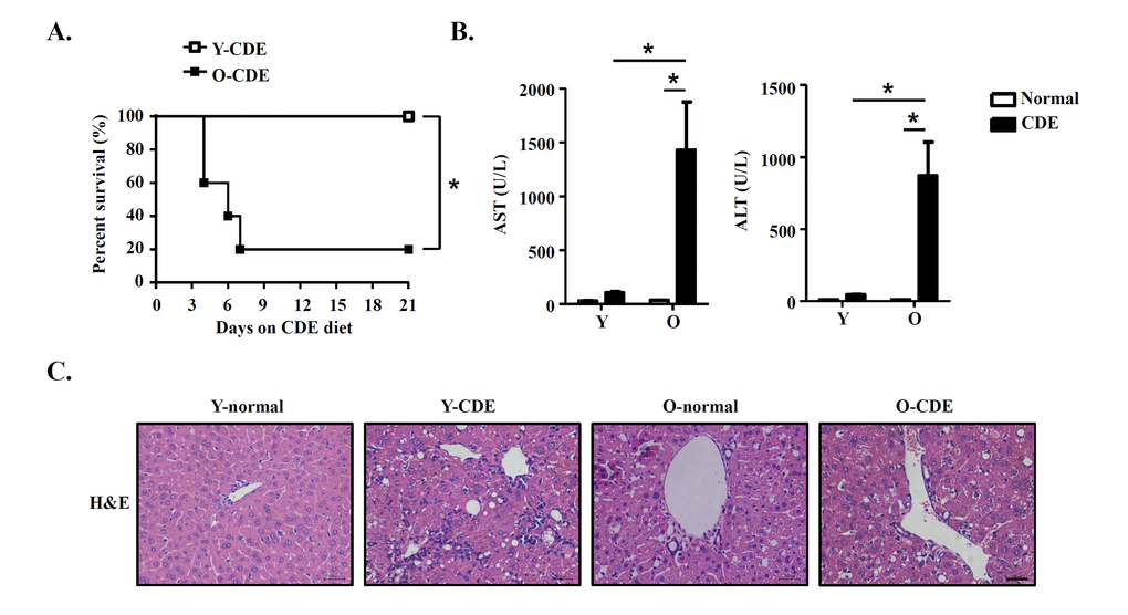 Liver injury in old mice with CDE diet. Y/O mice were fed with normal/CDE diet for 3 weeks. (A) Cumulative survival rates of Y/O mice with CDE diet were analyzed (n = 5 mice per group). (B-C) Serum and liver tissues from Y/O mice fed with normal/CDE diet were sampled on day 21. (B) Serum levels of AST and ALT were measured. Results are mean ± SEM from three independent experiments (n = 6 mice per group). (C) Liver tissues were sectioned for histological examination. Scale bar = 100 μm. Representative images from one experiment out of three are shown. *P 
