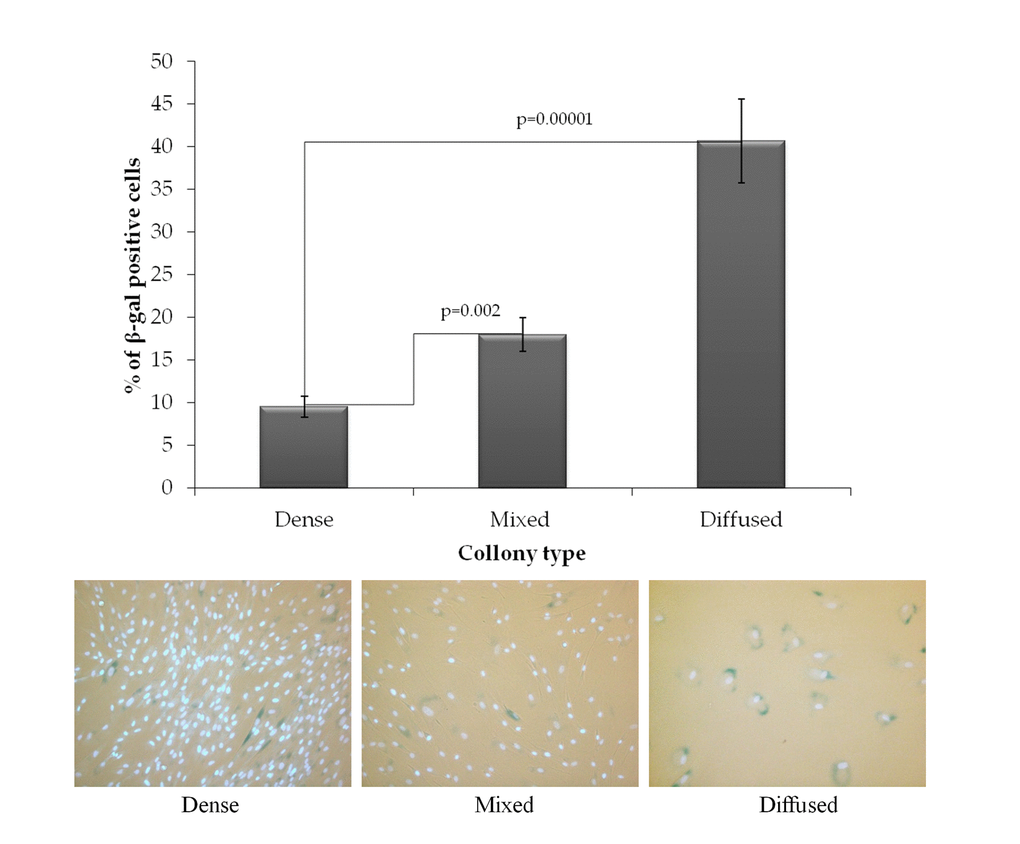 The fraction of SA-βgal positive cells in the colonies of various types. Top panel, the bar plot of mean values of 10 donors studied ± SEM. Bottom panel, representative images of the aging cells (cytoplasm colored dark blue) in each type of colonies. Nuclei were counterstained with Hoechst 33342 (bright light blue).