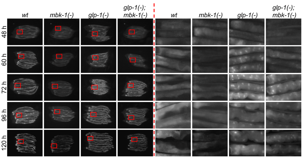 Loss of mbk-1 does not affect DAF-16 subcellular localization in germline-deficient C. elegans. The effect of the mbk-1 loss of function mutation mbk-1(pk1389) on subcellular localization of an intestine-specific GFP::DAF-16 protein (encoded by transgene muIs145[Pges-1::gfp::daf-16]) was determined at the times indicated in wild-type and germline-deficient glp-1(-) [glp-1(e2144ts)] animals. Images on the left were taken at 128x (48 h), 100x (60-96h) or 80x (120 h) magnification, images on the right are 6.5x magnifications of the areas boxed in red.