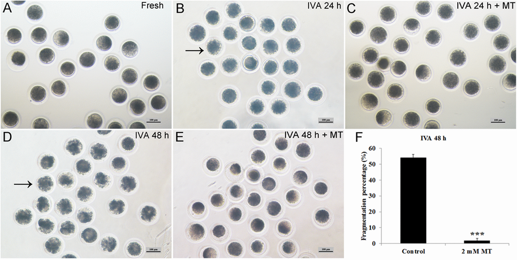 Effects of oocyte aging and melatonin on oocyte morphology. (A) Fresh oocytes. (B) Oocytes aged for 24 hr. (C) IVA 24 hr oocytes treated with 2mM melatonin. (D) Oocytes aged for 48 hr. (E) IVA 48 hr oocytes treated with 2mM melatonin. (F) Fragmentation percentage in oocytes aged for 48 hr and treated with 2mM melatonin for 48 hr. Oocytes with abnormal morphology were indicated by arrowheads. All graphs show mean ± s.e.m. Abbreviations used in this and all subsequent figures: MT, melatonin. Independent replicates were conducted with a minimum of 30 oocytes/replicate, at least 3 stable replicates were obtained. ***P 