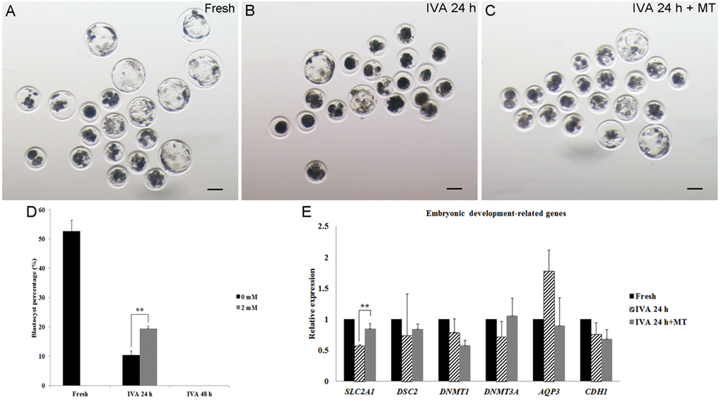 The development of embryos from fresh, aged and melatonin treated oocytes after parthenogenetic activation. (A) Fresh oocytes. (B) Oocytes aged for 24 hr in vitro. (C) IVA 24 hr oocytes treated with 2mM melatonin. (D) Blastocyst formation from fresh oocytes, IVA 24 hr or 48 hr oocytes and oocytes treated with melatonin for 24 hr or 48 hr after strong stimulus (800V, 40μs, 2 pulses). (E) The expression of embryonic development-related genes (SLC2A1, DSC2, DNMT1, DNMT3A, AQP3 and CDH1) in parthenogenetic blastocysts from fresh and aged oocytes. All graphs show mean ± s.e.m. Independent replicates were conducted with a minimum of 25 embryos/replicate, at least 3 stable replicates were obtained. **P 