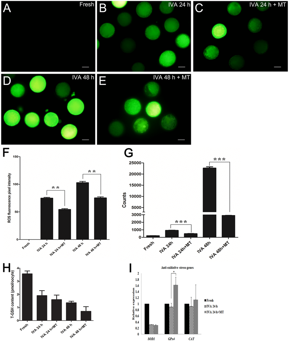 Effects of melatonin on ROS levels and total glutathione in aged oocytes. (A) Fresh oocytes. (B) Oocytes aged for 24 hr. (C) IVA 24 hr oocytes treated with 2 mM melatonin. (D) Oocytes aged for 48 hr. (E) IVA 48 hr oocytes treated with 2 mM melatonin. (F) ROS fluorescence pixel intensity in IVA oocytes. (G) ROS level (counts of photons) detection of single cell by optical nanoprobes. (H) Total glutathione (T-GSH) content in fresh and IVA oocytes. (I) The expression of anti-oxidative stress genes (SOD1, GPx4 and CAT) in fresh and aged oocytes. All graphs show mean ± s.e.m. Abbreviations used in this and all subsequent figures: ROS, reactive oxygen species. Independent replicates were conducted with a minimum of 30 oocytes/replicate, at least 3 stable replicates were obtained. **P 