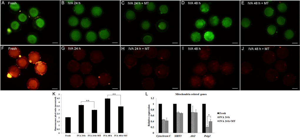 Effects of melatonin on mitochondrial membrane potential in aged and melatonin treated oocytes by JC-1 detection assay. (A) Green-Fresh oocytes. (B) Green-Oocytes aged for 24 hr. (C) Green-IVA 24 hr oocytes treated with 2mM melatonin. (D) Green-Oocytes aged for 48 hr. (E) Green-IVA 48 hr oocytes treated with 2mM melatonin. (F) Red-Fresh oocytes. (G). Red-Oocytes aged for 24 hr. (H) Red-IVA 24 hr oocytes treated with 2 mM melatonin. (I) Red-Oocytes aged for 48 hr. (J) Red-IVA 48 hr oocytes treated with 2 mM melatonin. (K) Fluorescence pixel ratio (green/red) in fresh and aged oocytes. (L) The expression of mitochondria-related genes (Cytochrome C, SIRT1, Akt2 and Polg2) in fresh and aged oocytes. All graphs show mean ± s.e.m. Independent replicates were conducted with a minimum of 25 oocytes/replicate, at least 3 stable replicates were obtained. **P 