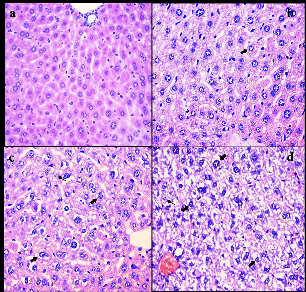 Histopathological changes in the liver at 42 days of the experiment. (a) The control group (H&E × 400). (b) The 12 mg/kg group. Hepatocytes show granular and vacuolar degeneration (⇑, H&E × 400). (c) The 24 mg/kg group. Hepatocytes show obvious granular and vacuolar degeneration (⇑). Also, necrotic hepatocytes are observed (↑, H&E × 400). (d) The 48 mg/kg group. Hepatocytes show marked vacuolar degeneration (⇑). Necrotic hepatocytes are observed (↑). And hepatic cords are disorganized or disappeared (H&E × 400).