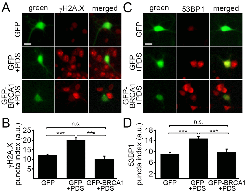 Ectopically expressed BRCA1 mitigates DNA damage associated with pyridostatin treatment. (А) Primary cortical neurons were transfected with GFP or with GFP-BRCA1 constructs, and then treated with a vehicle (control, GFP) or with 1 μM pyridostatin (GFP+PDS and GFP-BRCA1+PDS), overnight, fixed, and stained for a marker of DNA DSBs phosphorylated histone H2A variant X, γH2A.X (red). Scale bar is 10 μm. (B) The puncta index was estimated by measuring the standard deviation of the γH2A.X fluorescence intensity from (A). ***pC) Primary cortical neurons were transfected with GFP or with GFP-BRCA1 constructs, and then treated with a vehicle (control, GFP) or with 1 μM pyridostatin (GFP+PDS, GFP-BRCA1+PDS), overnight, fixed, and stained for a marker of DNA DSBs 53BP1 (red). Scale bar is 10 μm. (D) The puncta index was estimated by measuring the standard deviation of the γH2A.X fluorescence intensity from (C). ***p