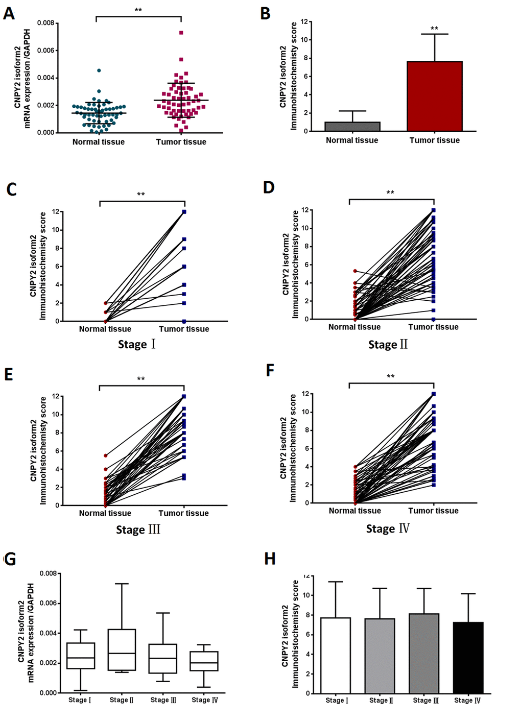 CNPY2 isoform2 expression in CRC tissues detected by RT-PCR and TMA-IHC. (A) Preferential expression of CNPY2 isoform2 mRNA was observed in CRC tissues compared matched tumor-adjacent normal tissues, (n = 57, **, P B) Increased expression of CNPY2 isoform2 protein was detected in tumor tissues compared to matched tumor-adjacent normal tissues among all patients (n = 285, 7.6 ± 0.2 vs. 1.0 ± 0.1, **, P C-F) Increased expression of CNPY2 isoform2 protein was detected in tumor tissues compared to matched tumor-adjacent normal tissues among patients with stage I-IV disease (C: Stage I,7.7 ± 0.6 vs. 0.5 ± 0.1; D: Stage II,7.4 ± 0.3 vs. 1.0 ± 0.2; E: Stage III,8.6 ± 0.3 vs. 1.3 ± 0.2; F: Stage IV,7.5 ± 0.4 vs. 1.0 ± 0.2; **, all P G) Expression level of CNPY2 isoform2 mRNA was slightly higher in stage II CRC but did not reach statistical significance compared to that in other stages (n = 57, P > 0.05). (H) CNPY2 isoform2 protein expression was comparable among patients with disease stage I-IV (n =2 85, P > 0.05).