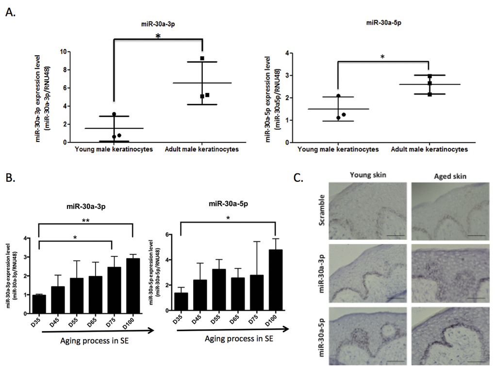 MiR-30a expression level during aging. The expression levels of miR-30a-3p and miR-30a-5p were evaluated by QPCR in (A) keratinocytes from infant and adult male donors and (B) skin equivalent (SE) model mimicking aging with a long time of culture: MiR-30a expression was monitored along the aging process from day 35 (D35) to day 100 (D100) of culture. For QPCR: results are mean +/- SD from three independent samples. *PC) The expression levels and the localization of miR-30a-3p and miR-30a-5p were evaluated by in situ hybridization in young and aged skin. Scale bar = 50 μm. Representative pictures were shown.