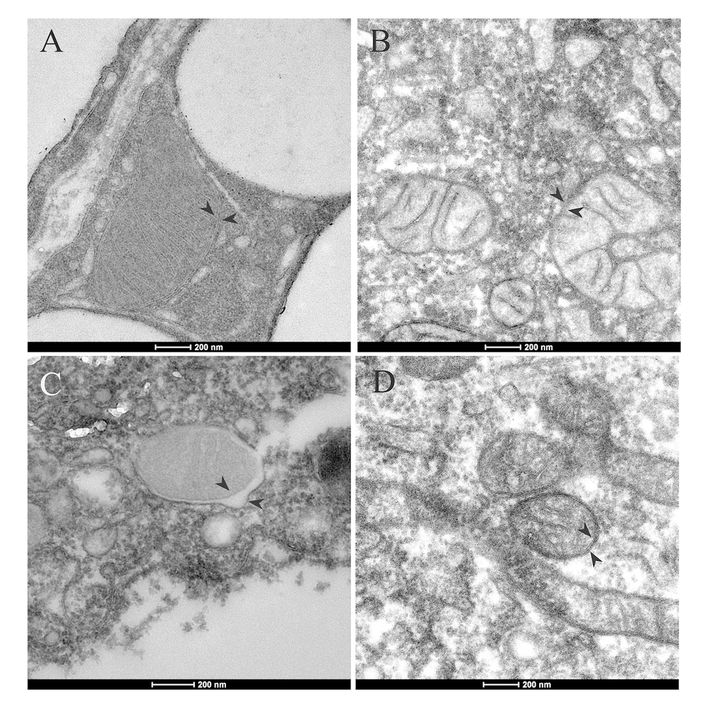 Mitochondrial ultrastructure in adipocytes and ADSCs of aged mice. Mitochondrial with normal cristae and morphology in adipocytes (A) and ADSCs (B) of young mice (8-week-old). (C) In the adipocytes of aged mice (1-year-old), alternations in mitochondrial morphology was shown. Mitochiondria had abnormal swelling and different electron densities between inner and outer mitochondrial membranes. (D) Mitochondrial morphology in ADSCs of old mice appeared normal. Arrowheads indicate mitochondrial inner and outer membrane.