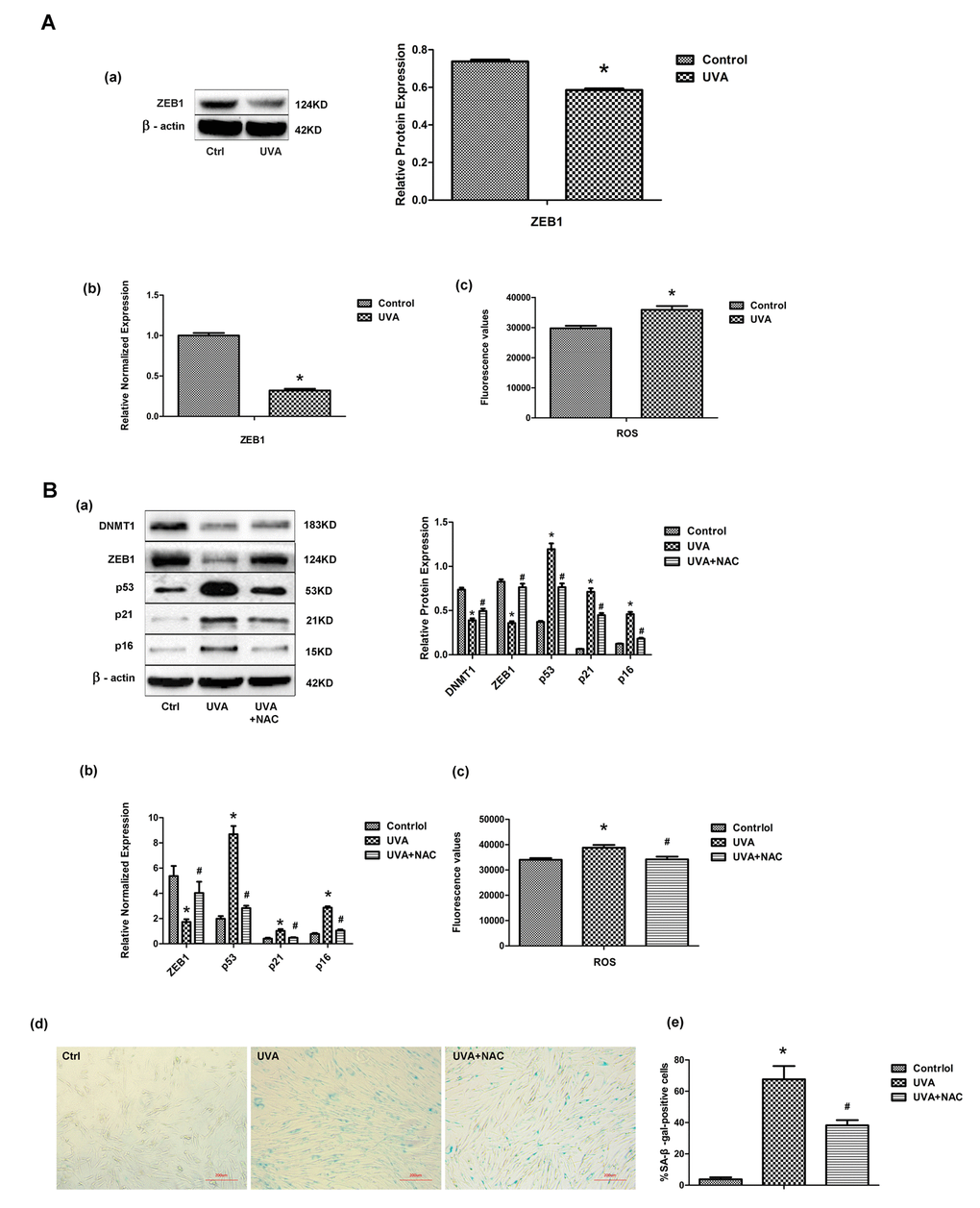 UVA irradiation regulates transcription factor ZEB1 via ROS. (A) ZEB1 mRNA (a) and protein (b) expression, assessed by real-time PCR and Western blotting, respectively, in irradiated and non-irradiated HDFs. Experiments were performed in triplicate. Intracellular ROS levels were assessed by measuring dichlorofluorescein (DCF) in triplicate experiments. * vs control, P B) Following treatment with N-acetyl-L-cysteine (NAC), the expression of ZEB1, p53, p21, and p16 was assessed at the protein (a) and mRNA (b) levels. Experiments were performed in triplicate. * vs control or UVA, P 