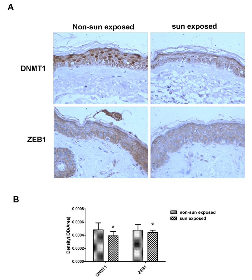 DNMT1 and ZEB1 expression is reduced in sun-exposed human skin. (A)Representative immunohistochemical staining images of matched human sun-exposed or non-sun-exposed skin specimens from within the same individual. Sections were imaged using primary antibodies raised against DNMT1 or ZEB1 (C, D) (Magnification= 400×). (B) Bar graph shows quantitative analysis of scanning density values of these proteins, * vs non-sun exposed, P 