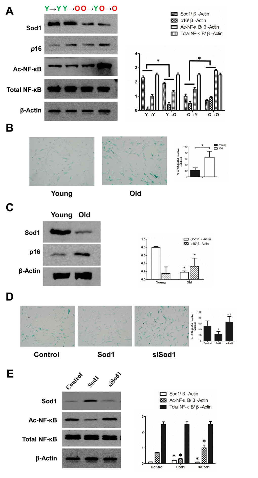 Expression of SOD1 and NF-κB in vivo and in vitro. (A) Expression of SOD1, p16 and NF-κB in kidney tissue from each group (*p B) SA-β-gal staining of young and old tubular epithelial cells. (C) Expression of SOD1 and p16 in young and old tubular epithelial cells (*p D) SA-β-gal staining of tubular epithelial cells after the indicated interventions (*p D) Expression of NF-κB in tubular epithelial cells after the indicated interventions (*p 