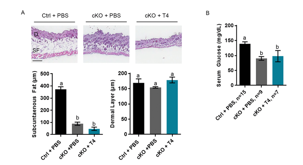 Low subcutaneous fat or serum glucose are not rescued by T4 administration in Atrx Foxg1cre (cKO) mice. (a) H & E staining of P20 skin cryosections shows that subcutaneous fat (SF) is not restored to control levels in Atrx Foxg1cre mice following T4 treatment (n=3). Dermal layer (D) was unchanged between control and either PBS or T4 treated Atrx Foxg1cre mice as previously reported (Scale bar = 200 µm). (b) Serum glucose at P14 was not restored to control levels in Atrx Foxg1cre mice following T4 treatment. Groups with the same letter have means that are not significantly different. Groups with different letters have means that are significantly different (p