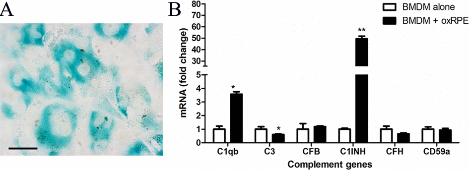 The effects of oxidized POS treated-RPE cell on BMDM complement gene expression. RPE cells were treated with oxidized photoreceptor outer segments (oxPOS) for 24h. oxPOS were then removed from the culture. (A) β-galactosidase expression in ox-POS-treated RPE cells. (B) The oxPOS pre-treated RPE cells were co-cultured with naïve BMDMs for 7h. Macrophages were isolated and processed for real-time RT-PCR analysis of complement genes. Mean ± SEM, n =3; *, P