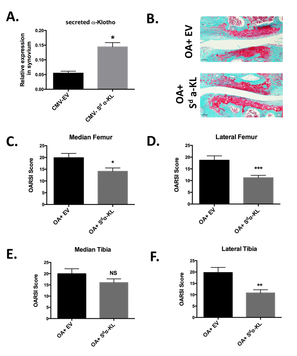Effect of intra-articular secreted α-KL gene transfer in an experimental murine OA model. (A) Secreted α-KL gene expression in mice synovium after electrotransfer of empty vector (CMV-EV) or CMV-Sd-α-KL expressing vector. (B) Representative Safranin-O Fast-Green staining of knee joints from OA mice treated with empty vector (OA+EV) or CMV-Sd-α-KL expressing vector (OA+Sd-α-KL). (C-F) OARSI scores in the different joint localizations from OA mice after intra-articular electrotransfer of empty vector (OA+EV; n=15) or CMV-Sd-α-KL expressing vector (OA+Sd-α-KL; n=25). Data are represented as mean -/+ SEM. *=p