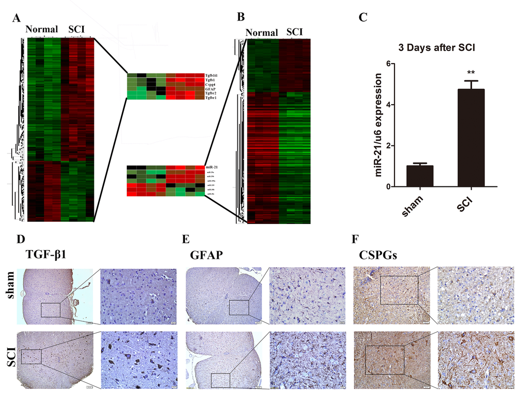 Astrocytes were activated and miR-21, TGF-β1, and CSPGs were upregulated after SCI. (A) Heat map of miRs with significantly altered expression in 3 days after SCI group compared with the sham group (n = 4). (B) Heat map of mRNAs with significantly altered expression in the 3 days after SCI group compared with sham group (n = 4). (C) qRT-PCR for miR-21 expression in sham and 3 days after SCI groups (n = 3). Data are expressed as mean ± SD. **P D), GFAP (scale bar: low magnification, 100μm; high magnification, 20μm) (E) and CSPGs (scale bar: low magnification, 50μm; high magnification, 20μm) (F) in sham and 3 days after SCI group (n = 3). CSPGs, chondroitin sulfate proteoglycans; GFAP, glial fibrillary acidic protein; miR, microRNA; qRT-PCR, quantitative real-time polymerase chain reaction; SCI, spinal cord injury; SD, standard deviation; TGF-β1, transforming growth factor beta 1.