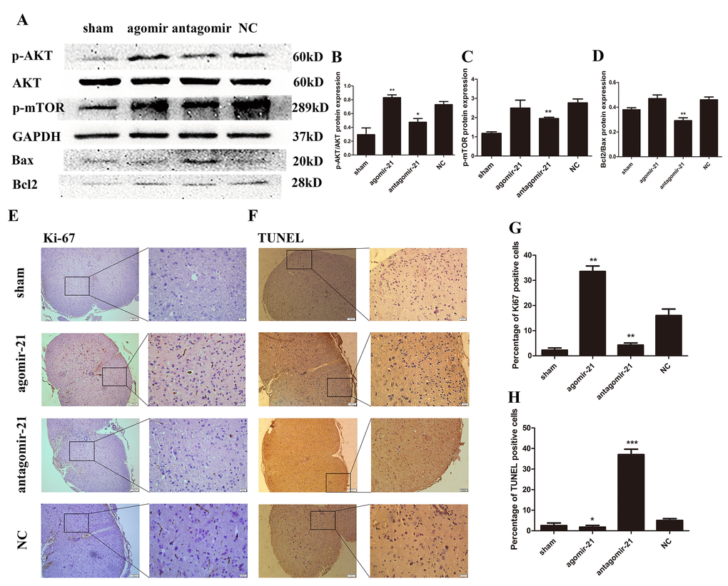 miR-21 regulates astrogliosis through the Akt/mTOR signaling pathway. To determine the effects of miR-21 in the regulation of proliferation and apoptosis in vivo, expression of miR-21 was interrupted in a SCI mouse model. Mice were divided into four groups: sham, agomir-21, antagomir-21 and NC. (A) p-AKT, AKT, p-mTOR, Bax and Bcl2 were detected by Western blot and analyzed by ImageJ and SPSS (B-D). (E) the expression of Ki-67 was detected by immunohistochemistry (scale bar: low magnification, 100μm; high magnification, 20μm) and analyzed by ImageJ and SPSS. (G). (F) TUNEL assay (scale bar: low magnification, 100μm; high magnification, 20μm) was performed and analyzed by ImageJ and SPSS (H). Data are expressed as mean ± SD. *P 