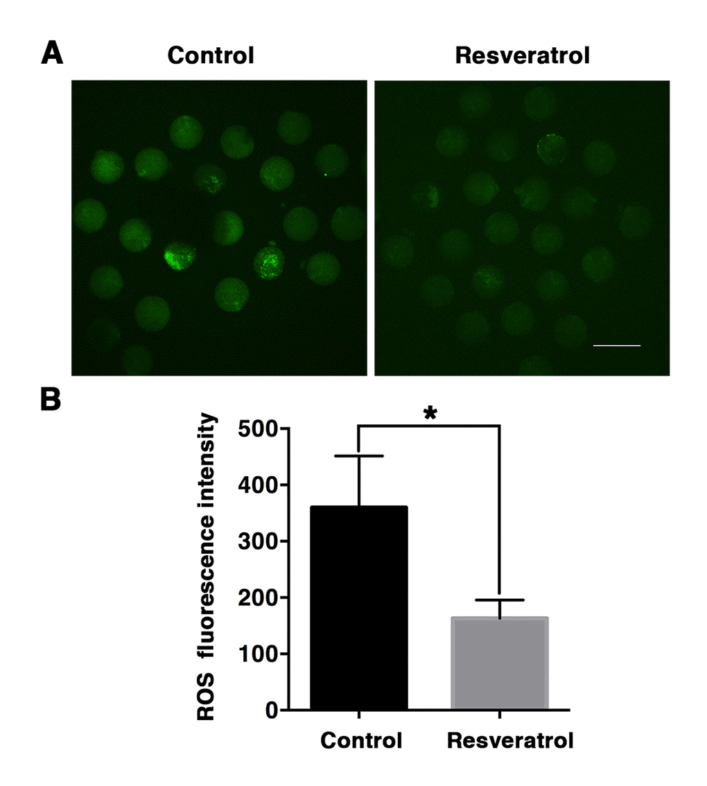 Detection of ROS production in MII oocytes during aging in vivo. (A) Representative confocal images of DCF fluorescence in control and resveratrol-treated oocytes. ROS production was measured by fluorescent probe DCFA-DA (green). Scale bar: 100 μm. (B) The relative levels of intracellular ROS determined by quantitative fluorescence intensity. Data are expressed as mean ± SEM of at least 5 independent experiments. *Significantly different (P 