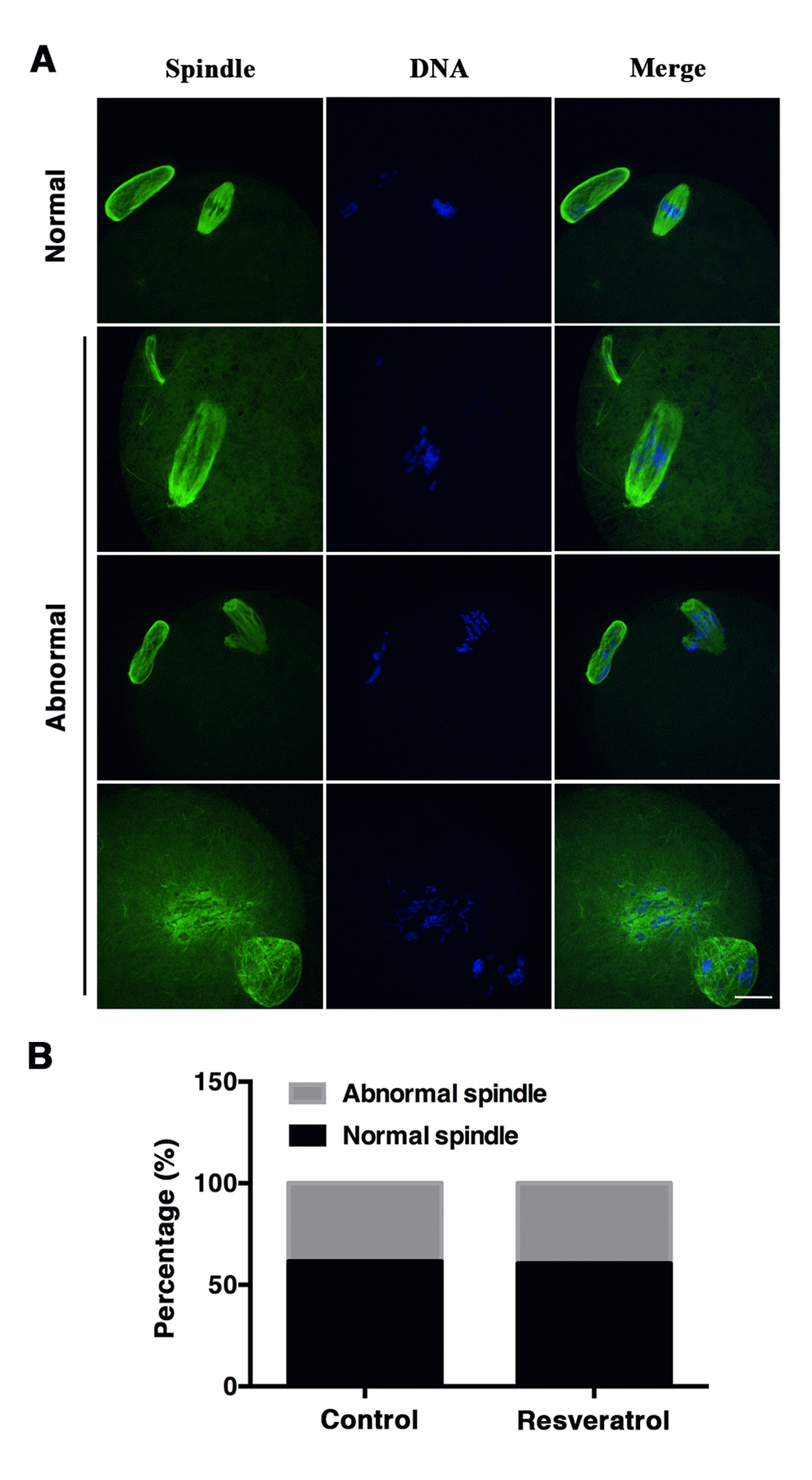 (A) Immunofluorescent images of normal and abnormal spindle morphology of control and resveratrol-treated oocytes. Oocytes were stained with α-tubulin antibody (green) and Hoechst (blue) to show spindle morphology and chromosome alignment, respectively. Scale bar: 20 μm. (B) Proportions of the normal and abnormal spindle morphology of aging MII oocytes from control and resveratrol-treated groups. Data are expressed as mean ± SEM of at least 5 independent experiments.