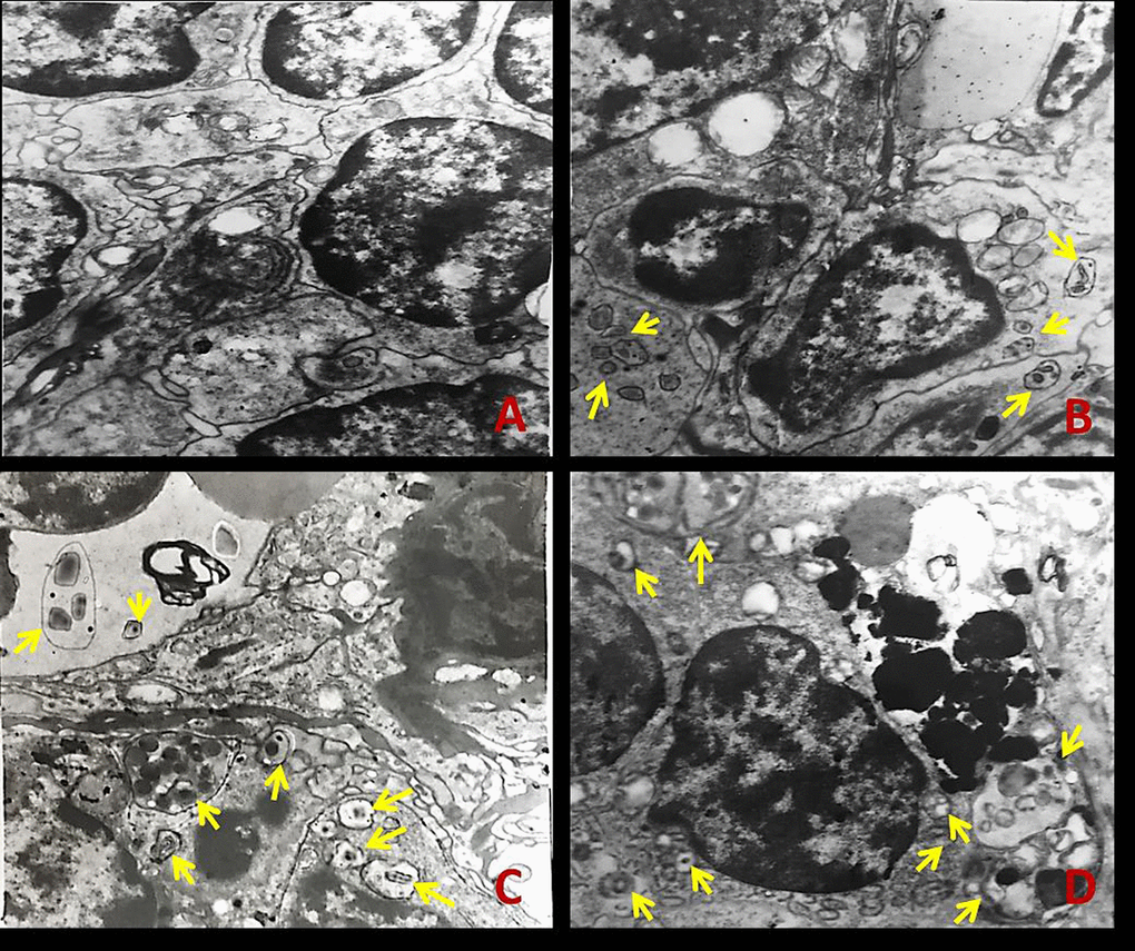 The ultrastructure of spleen tissue by transmission electron microscopy (TEM) at 42 days of the experiment. The yellow arrows represent autophagosome or autolysosome. (A) Control group; (B) 12 mg/kg group; (C) 24 mg/kg group; (D) 48 mg/kg group.