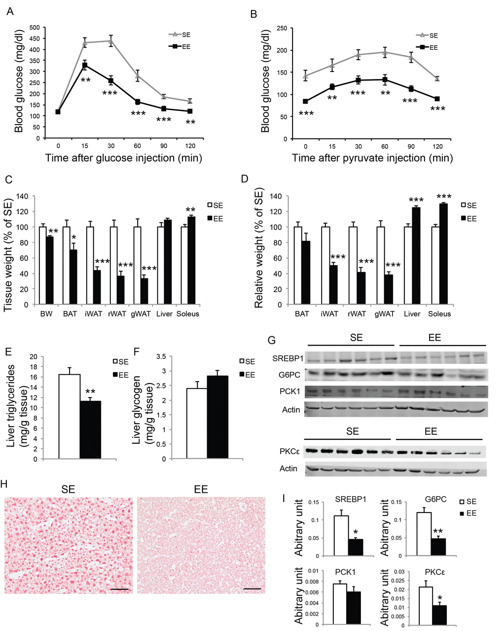 Short-term EE modulates liver phenotypes in middle age mice. (A) Glucose tolerance test at 6-week in EE (n=10 per group). (B) Pyruvate tolerance test at 7-week in EE (n=10 per group). (C) Body and tissue weight at sacrifice after 8-week EE (n=10 per group). (D) Relative tissue mass calibrated to body weight (n=10 per group). (E) Liver triglycerides level (n=10 per group). (F) Liver glycogen level (n=10 per group). (G) Western blotting of livers. (H) Oil red O staining of livers. Scale bar, 50 µm. (I) Quantification of western blotting of the livers in (G), n=6 per group. * PPP