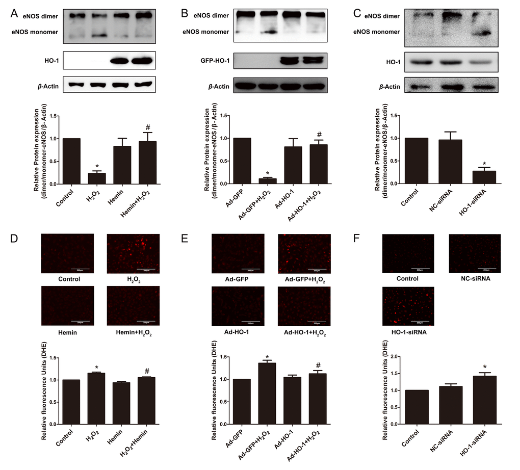 HO-1 protected the coupling state of eNOS in endothelial senescence. (A) HO-1 inducer Hemin increased the downregulation of dimer/monomer-eNOS ratio stimulated by H2O2. *P #P 2O2. n = 6. (B) Overexpression of HO-1 infected by recombinant adenovirus increased the downregulation of dimer/monomer-eNOS ratio stimulated by H2O2. *P #P 2O2. n = 3. (C) Silencing of HO-1 decreased the dimer/monomer-eNOS ratio. *P D, E and F) Images of DHE fluorescence staining taken by confocal microscopy showing ROS production in HUVECs (200 × magnification). The fluorescence intensity of DHE was normalized to the cell numbers by normalizing to DAPI fluorescence (not shown). (D) treated with or without H2O2 and Hemin. *P #P 2O2. n = 4. (E) infected with or without HO-1 recombinant adenovirus. *P #P 2O2. n = 6. (F) transfected with or without HO-1 siRNA. *P 