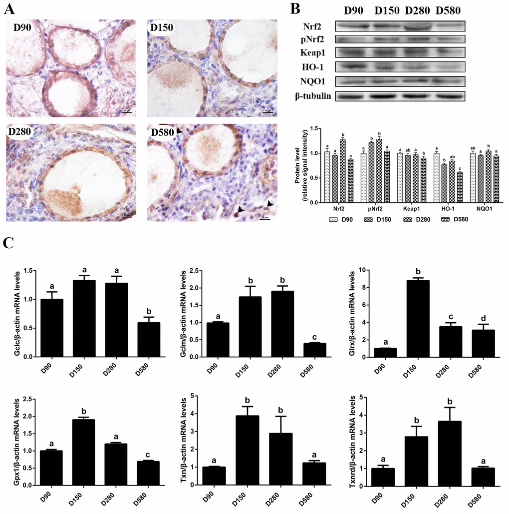 Age-related changes in the activity of the Nrf2/HO-1 pathway. (A) Immunohistochemistry of Nrf2 in the ovaries of hens aged 90, 150, 280 and 580 days, scale bar: 10 μm, black arrowheads: Nrf2 located in the nucleus. (B) Age-related changes in relative expression levels of Nrf2, pNrf2, Keap1, HO-1 and NQO1. (C) Age-related changes in transcription levels of Nrf2/HO-1 downstream genes: Gclc, Gclm, Glrx, Gpx1, Txn, Txnrd. Values are expressed as the means±s.e.. The relative abundance of each transcript was normalized to a β-actin and expressed as fold change over D90 ovaries. Different lowercase letters indicate significant differences (P 