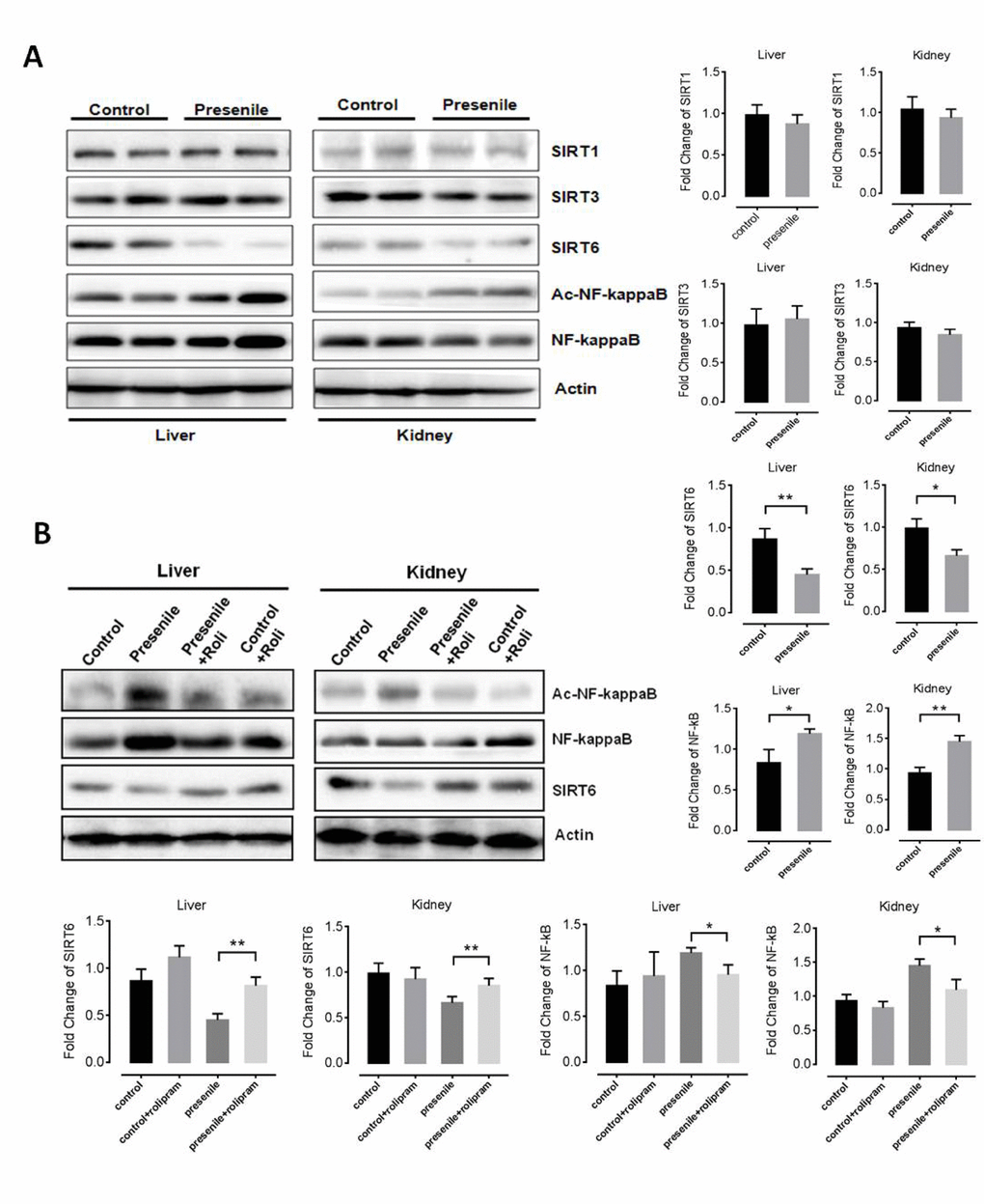 Rolipram increases levels of SIRT6. (A) Western blots results for SIRT1, SIRT3, SIRT6 and acetylated NF-κB in the livers and kidneys of presenile mice. (B) Western blot results for SIRT1, SIRT3, SIRT6 and acetylated NF-κB in the livers and kidneys of presenile mice, with or without rolipram treatment.