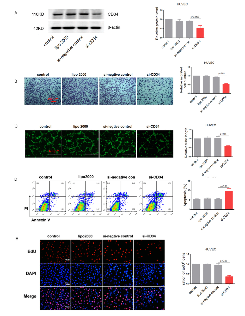 Down-regulation of CD34 impairs endothelium function in vitro. (A) CD34 protein levels in treated HUVEC cells detected by Western blotting. (B) Migration evaluated by transwell experiment in HUVEC cells. (C) Tube formation determined on Matrigel in HUVEC cells. (D) Apoptosis measured by Annexin V/PI flow cytometric analysis in HUVEC cells. (E) Proliferation detected by EdU incorporation assays in HUVEC cells. Data are representative of four experiments, n=4. Data are expressed as mean ± SEM.