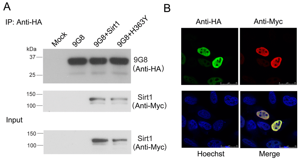 Sirt1 interacts with 9G8 directly. (A) Myc-tagged SIRT1 and HA-tagged 9G8 were co-expressed in HEK-293T cells. After 48 h transfection, cell lysate was incubated with anti-HA antibody coupled onto protein G beads. The proteins bound on beads were analyzed by western blot developed with anti-HA and anti-Myc. (B) Sirt1 tagged with Myc and 9G8 tagged with HA were co-overexpressed in Hela cells. After 48 h transfection, the cells were fixed and immunostained with anti-HA or anti-Myc and followed by TRITC-anti-rabbit IgG or FITC-anti-mouse IgG. Hoechst was used for nuclear staining.