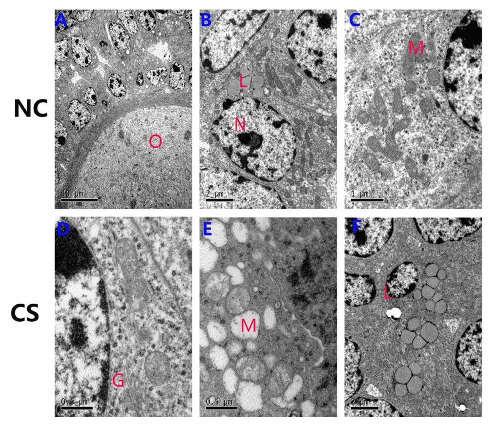 Ultrastructural changes of the ovarian granulosa cells in both groups. (A-C) The normal ultrastructure in the ovaries of NC mice. Few lipids were observed in the ovaries, and most mitochondria structures were normal. (D-F) The mitochondria were swollen, exhibited decreased matrix density, and developed flocculent dense bodies in the matrix space in the RS group mice. The number of lipid droplets and swollen Golgi complexes were increased in RS group mice. (O: oocyte; N: nucleus of granulosa cells; M: mitochondrial; L: lipid; G: Golgi complex).