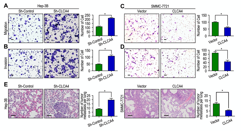 CLCA4 inhibits cell migration and invasion in HCC cell lines. (A, B) CLCA4 silenced in Hep-3B cells and promoted cell migration and invasion. (C, D) CLCA4 up-regulated in SMMC-7721 cells and inhibited cell migration and invasion. (E) Lung H&E staining of nude mice inoculated Hep-3B and SMMC-7721 transfected cells via tail vein. The number of lung tumor nodules in each group were also calculated, * P 