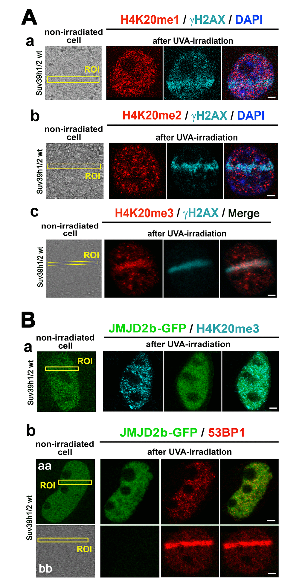 The nuclear distribution pattern of H4K20me1/me2/me3 at DNA lesions. (A) The levels of (a) H4K20me1 (red) in γH2AX-positive DNA lesions (magenta), (b) H4K20me2 (red) in γH2AX-positive DNA lesions (magenta), and (c) H4K20me3 (red) in DNA lesions studied in parallel with γH2AX (magenta). (B) The level of (a) H4K20me3 and (b) 53BP1 in micro-irradiated ROI of the cells over-expressing JMJD2b histone demethylase, tagged by GFP. Panels Bb-aa show low level of 53BP1 at micro-irradiation induced DNA lesions in cells over-expressing GFP-tagged JMJD2b and panel Bb-bb documents 53BP1 recruitment to DSB sites in the cells with a normal expression of JMJD2b. Scale bars in all panels represent 5 µm.