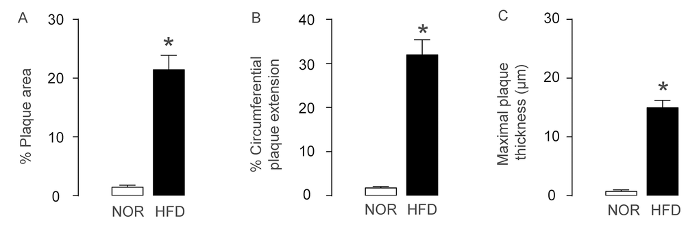 AS is induced HFD-treated ApoE (-/-) mice. ApoE (-/-) mice were fed with High-fat diet (HFD; simplified as HFD mice) for 12 weeks to induce experimental AS. The littermate ApoE (-/-) mice that had received normal diet (NOR) were used as a control. (A) Plaque area. (B) Circumferential plaque extension. (C) Maximal plaque thickness. *p