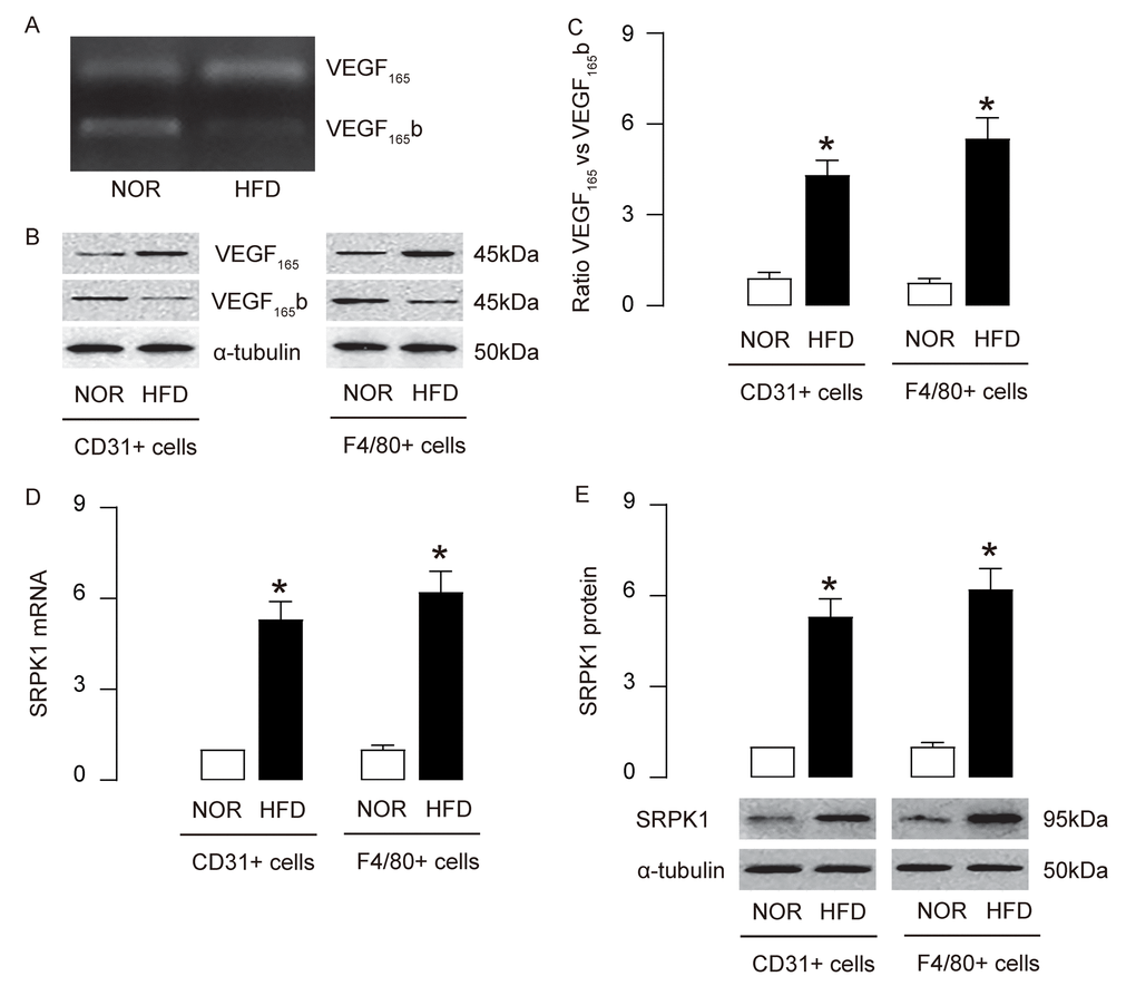 Upregulation of SRPK1 promotes pro-angiogenic splicing of VEGF-A in HFD mice. (A) Conventional PCR to show the bands for the anti-angiogenic splicing form of VEGF-A (VEGF165b) and the pro-angiogenic splicing form of VEGF-A (VEGF165) in mouse aorta. (B-C) Western blotting for VEGF165b and VEGF165 in CD31+ AECs and F4/80+ macrophages, shown by representative blots (B) and by quantification (C). (D-E) RT-qPCR (D) and Western blotting (E) for SRPK1 levels in CD31+ AECs and F4/80+ macrophages. *p