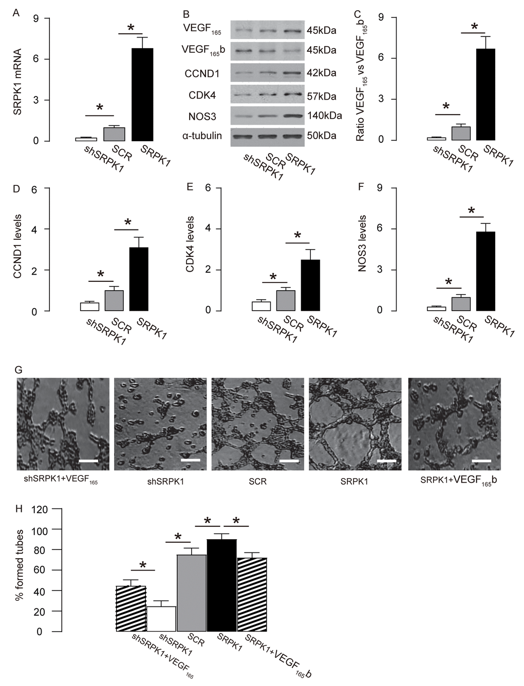 SRPK1 promotes AEC proliferation through increasing pro-angiogenic splicing of VEGF-A in vitro. (A) RT-qPCR for SRPK1 in shSRPK1, or SCR, or SRPK1- transfected MS1 cells. (B) Representative western blots of SRPK1-modified MS1 cells. (C-F) Quantification of ratio of VEGF165 versus VEGF165b (C), CCND1 (D), CDK4 (E) and NOS3 (F) protein levels in SRPK1-modified MS1 cells. (G-H) Tube formation assay using SRPK1/VEGF165/VEGF165b -modified MS1 cells, shown by representative images (G), and by quantification (H). *p