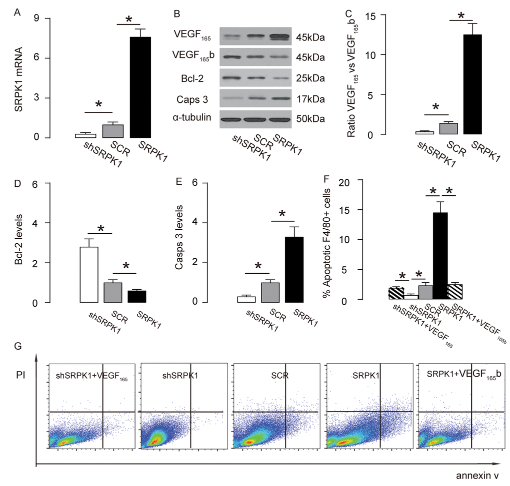 SRPK1 promotes macrophage apoptosis through increasing pro-angiogenic splicing of VEGF-A in vitro. (A) RT-qPCR for SRPK1 in shSRPK1, or SCR, or SRPK1- transfected RAW264.7 cells. (B) Representative western blots of SRPK1-modified RAW264.7 cells. (C-E) Quantification of ratio of VEGF165 versus VEGF165b (C), Bcl-2 (D) and Casps 3 (E) protein levels in SRPK1-modified RAW264.7 cells. (F-G) Annexin V assay for SRPK1/VEGF165 /VEGF165b -modified RAW264.7 cells, shown by quantification (F), and by representative flow charts (G). *p