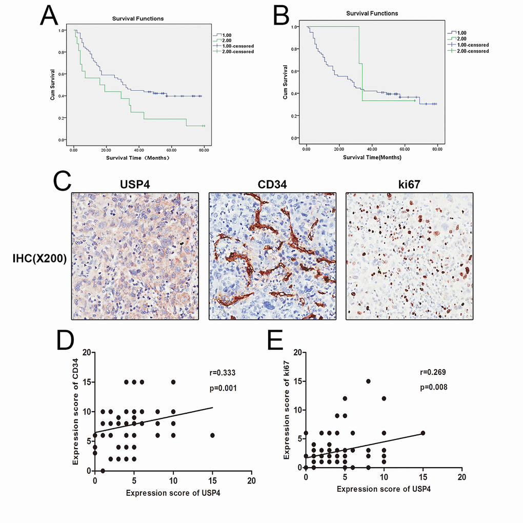 High expression of USP4 was positive associated with HCC poor survival and some pathological characteristics. (A) Kaplan–Meier survival curve showed the correlation between USP4 expression in tumor tissues and survival of patients with HCC, (P=0.032), 1: low USP4 expression, 2: high USP4 expression. (B) Kaplan–Meier survival curve shows the correlation between USP4 expression in matched surrounding tissues and survival of patients with HCC, (P=0.708), 1: low USP4 expression, 2: high USP4 expression. (C) USP4, Ki67 and CD34 expression were tested by immunohistochemical staining in HCC tissues (magnification, ×200). (D) USP4 expression was positively correlated with the expression of Ki67(p=0.001, r=0.333). (E) USP4 expression was positively correlated with the expression of CD34 (p=0.008, r=0.269).