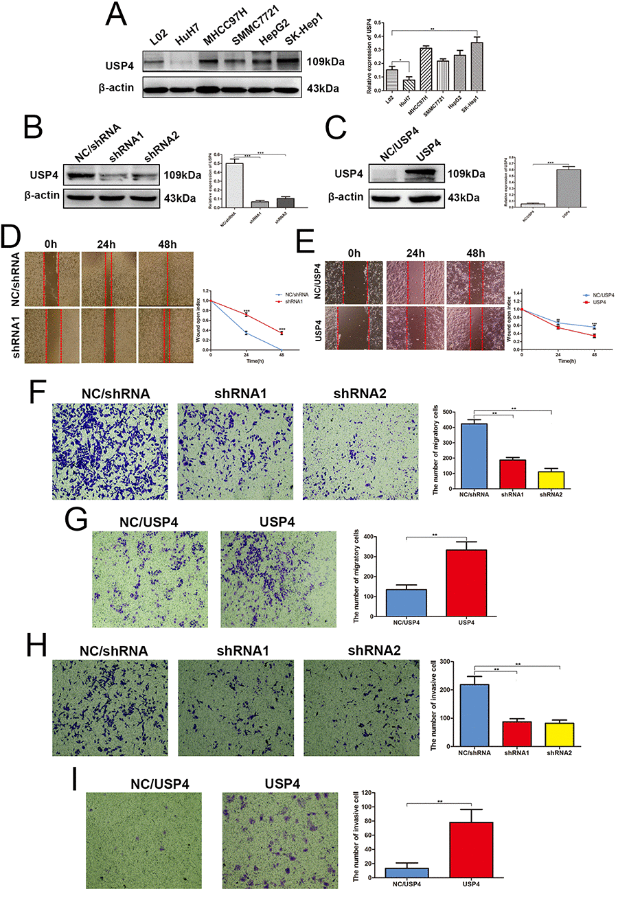 USP4 expression significantly impacted HCC cell migration and invasion in vitro. (A) USP4 expression was aberrant in HCC cell lines, as compared to the normal liver cell lines L02 (* P B) USP4 expression was knocked down by lentivirus technology in SK-Hep1cells (** P C) USP4 was overexpressed by lentivirus technology in HuH7 cells (*** P D) Wound-healing assays detected the effect of USP4 knockdown on the healing ability of SK-Hep1 cells (*** P E) Wound-healing assays detected the effect of USP4 overexpression on the healing ability of HuH7 cells (** P F) Transwell assays evaluated the effect of USP4 knockdown on the migratory ability of SK-Hep1cells (** P G) Transwell assays evaluated the effect of USP4 overexpression on the migratory ability of HuH7 cells (** P H) Matrigel invasion assays examined the effect of USP4 knockdown on the invasive ability of SK-hep1 cells (** P I) Matrigel invasion assays examined the effect of USP4 overexpression on the invasive ability of HuH7 cells (** P 