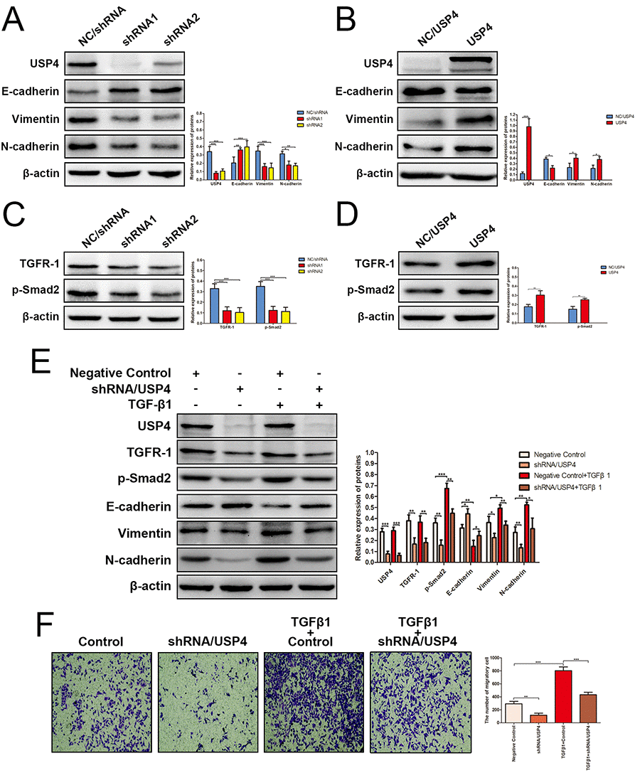 USP4 activated TGF-β signaling pathway to induce epithelial-to-mesenchymal transition (EMT). (A) The expression of EMT markers in SK-Hep1- shRNA/USP4 cells and in negative control cells (* P B) The expression of EMT markers in HuH7-USP4 cells and in negative control cells (* P C) The expression of TGFR-1 and p-Smad2 in SK-Hep1- shRNA/USP4 cells and in negative control cells (*** P D) The expression of TGFR-1 and p-Smad2 in HuH7-USP4 cells and in negative control cells (* P E) The expression of TGFR-1, p-Smad2 and EMT markers in SK-Hep1- shRNA/USP4 cells or in negative control cells, with TGF-β1(10ng/mL)treatment for 24h or without (* P F) The migration ability of SK-Hep1-shRNA/USP4 cells or negative control cells, with TGF-β1 treatment or without, detected by Transwell migration assay (** P 