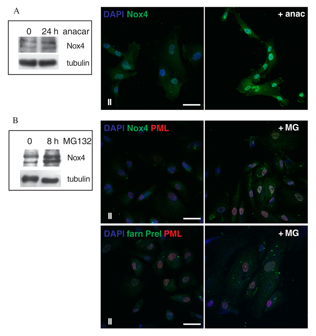 Effect of Anacardic Acid and MG132 treatment on Nox4 expression. (A) Representative image of Western blot analysis of AFSCs group II samples (intermediate senescent cells) used as control (0) or treated with anacardic acid for 24 h and then revealed with anti-Nox4. Tubulin detection was performed as a loading control. Data are representative of three independent experiments. On the right, representative images showing superimposing between DAPI (blue) and Nox-4 (green) of control or anacardic acid treated samples. Scale bar= 10 µm. (B) Representative image of Western blot analysis of AFSCs group II samples used as control (0) or treated with MG132 for 8 h and then revealed with anti-Nox4. Tubulin detection was performed as a loading control. Data are representative of three independent experiments. On the right, representative images showing superimposing among DAPI (blue), Nox-4 (green) or farnesylated Prelamin (green) and PML (red) of control or MG132 treated samples. Scale bar= 20 µm.