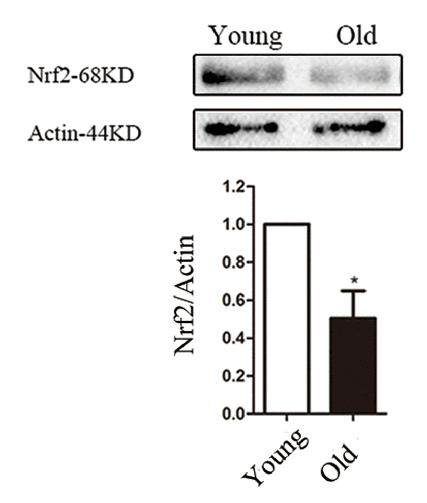 Nrf2 decline in old mouse oocytes. Western blot analysis revealed a reduced Nrf2 expression in mouse oocytes from aged females compared with those from young controls. Actin served as a loading control throughout. Band intensity was calculated using ImageJ software, the ratio of Nrf2/Actin expression was normalized and values are indicated. Data are expressed as the mean ± SD, *P