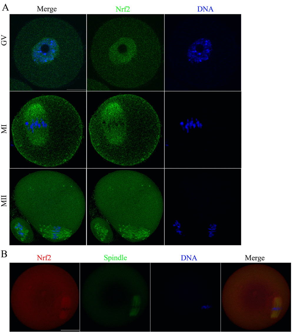 Cellular distribution of Nrf2 during oocyte meiosis. (A) Immunofluorescent staining was employed to show the subcellular localization of Nrf2. Green, Nrf2; Blue, chromatin. A total of 30 oocytes were examined for each group. Scale bar, 20 μm. (B) Immunoﬂuorescent staining for co-localization of α-tubulin with Nrf2 in mouse oocytes. This shows the co-localization of Nrf2 with spindles in mouse oocyte. Red, Nrf2; green, tubulin; blue, chromatin. Scale bar, 20 μm.