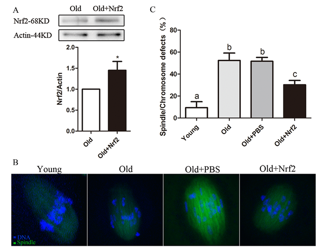 Maternal age-associated oocyte spindle and chromosome abnormalities suppressed by Nrf2 overexpression. (A) PBS (control group) or Nrf2 plasmid (overexpression group) was microinjected into old GV oocytes, which were arrested for 20 h with milrinone to allow synthesis of new Nrf2 protein. Results indicated that Nrf2 protein was efﬁciently overexpressed. (B) Representative examples of meiotic spindle and chromosomes at MII stage in young oocytes, old oocytes and old oocytes injected with PBS or Nrf2 plasmid. Arrowheads indicate misaligned chromosomes. (C) Incidence of spindle/chromosome defects in indicated oocytes. Data are expressed as the mean ± SD percentage from 3 independent experiments in which 100 oocytes were analyzed, *P