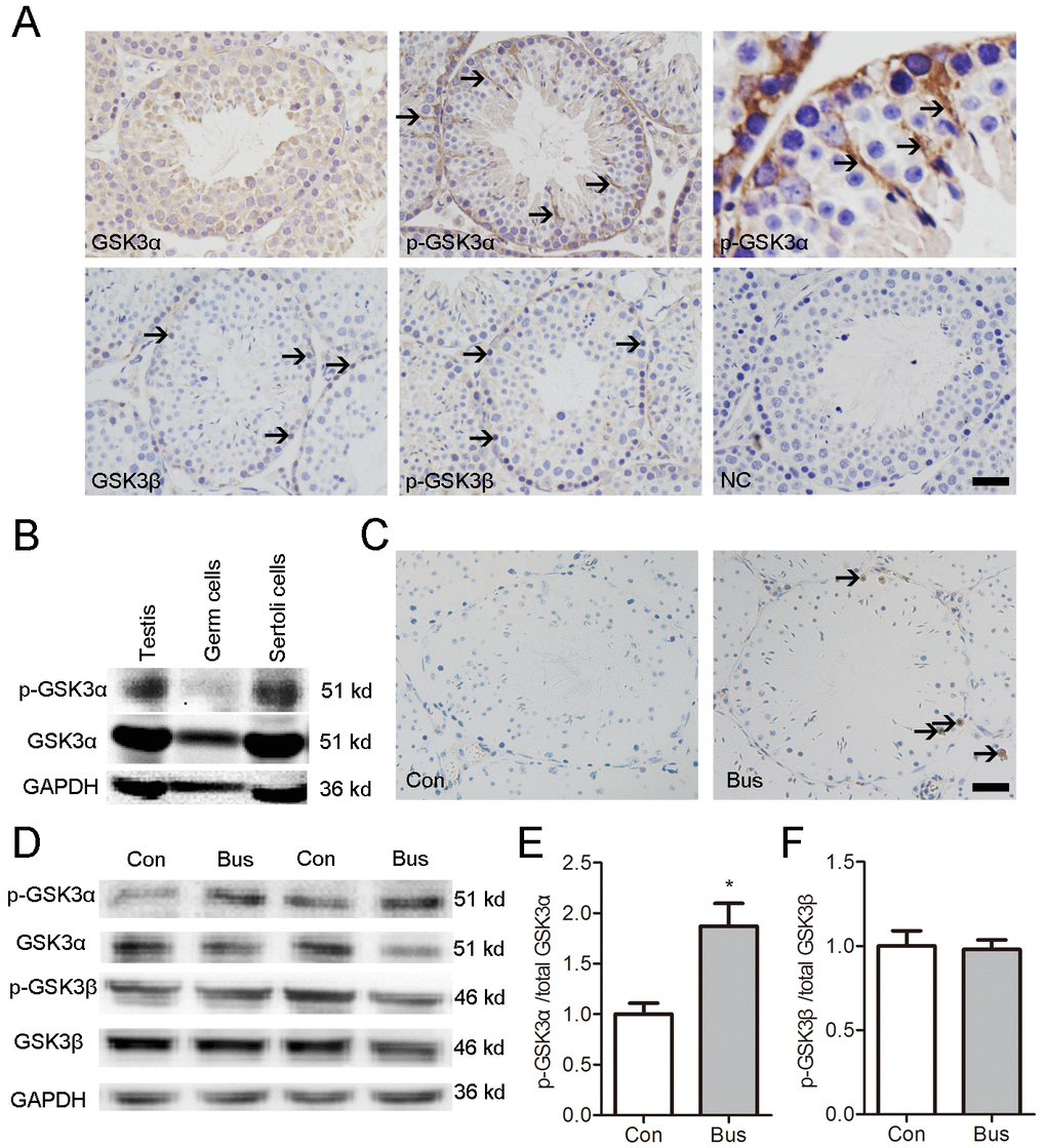 Localization of p-GSK3α in mouse testis and association between apoptotic germ cells and p-GSK3α in Sertoli cells. (A) Representative microscopic images of GSK3α, p-GSK3α, GSK3β, and p-GSK3β in mouse testis evaluated by immunohistochemistry. (B) Protein levels of GSK3α and p-GSK3α in germ cells and Sertoli cells evaluated by western blot. (C) TUNEL staining of testicular sections were carried out at 14 d after busulfan treatment. Brown nuclear staining indicates apoptotic cells (arrow). (D) Western blots showing the protein levels of p-GSK3α, total GSK3α, p-GSK3β and total GSK3β in testis of adult mice after busulfan treatment for 14 d. (E) Histogram indicates the ratio of p-GSK3α/GSK3α. (F) Histogram indicates the ratio of p-GSK3β/GSK3β. Con, control; Bus, busulfan. Scale bars = 50 μm. Values are expressed as the mean±SEM, n=6; * P 