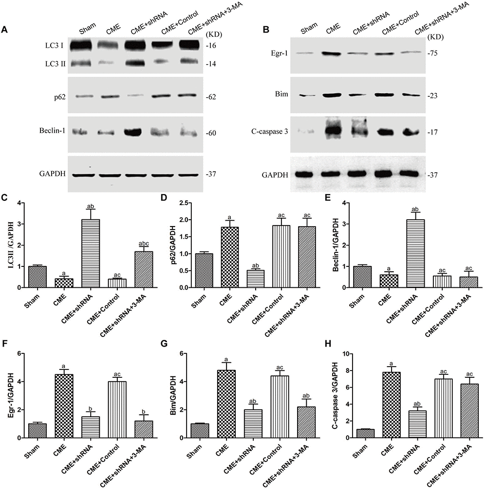 The Egr-1/Bim/Beclin-1 pathway regulated autophagy and apoptosis during CME-induced myocardial injury. (A) Representative western blots of autophagy-associated proteins. (B) Representative western blots of apoptosis-associated and Egr-1/Bim/Beclin-1 pathway proteins. c-h Levels of the (C) LC3-II, (D) p62, (E) Beclin-1, (F) Egr-1, (G) Bim, and (H) cleaved caspase-3 normalized to GAPDH. The results are presented as the means ± SD from at least three independent experiments. aP bP cP 