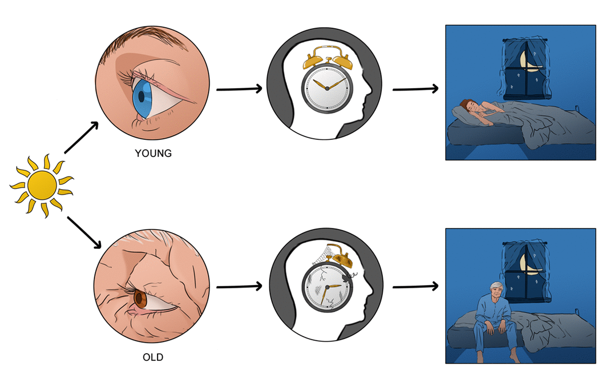 Aging Clocks Disrupted Circadian Rhythms Figure F1 Aging