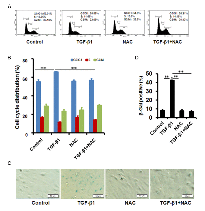 TGF-β1 induces cellular senescence in B4G12 cells. (A-B) The G1 phase arrest was induced by TGF-β1 treatment. Control and TGF-β1–treated B4G12 cells were subjected to cell cycle analysis after 48h-treatment. A representative ﬂow cytometric analysis of the DNA content was shown in (A) and the values are mean±SD in (B). (C-D) SA-β-Gal activity was measured in B4G12 cells treated with 10 ng/ml TGF-β1 alone, or in combination with NAC (10mM) for 72h. NAC treatment alone (10mM) did not affect the cell cycle status and SA-β-Gal activity. Bar graphs represent mean±SD. *PP