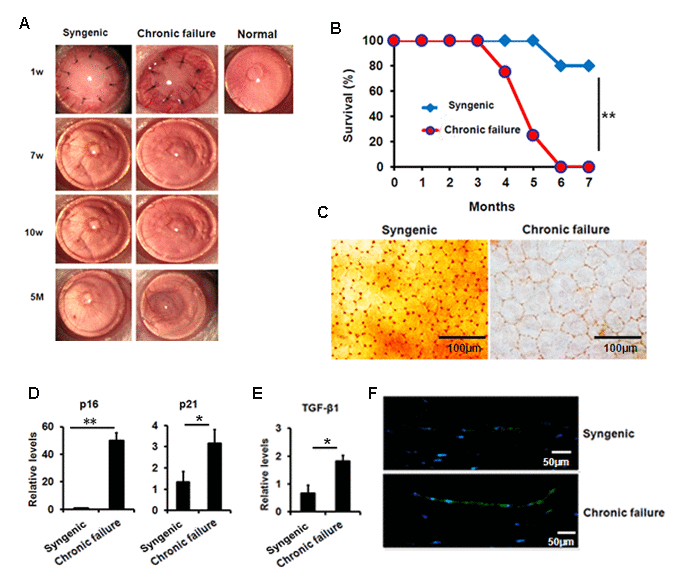 Premature senescence and elevated TGF-β1 in the murine CE with chronic failure. (A-C) Corneal graft phenotype in syngenic and chronic failure mouse model (D-E) p21, p16 (D) and TGF-β1 (E) expression was measured at transcription level in the murine CE from syngenic and chronic failure group. (F) Representative photographs for the IF staining of TGF-β1 in the CE with chronic graft failure. **PP