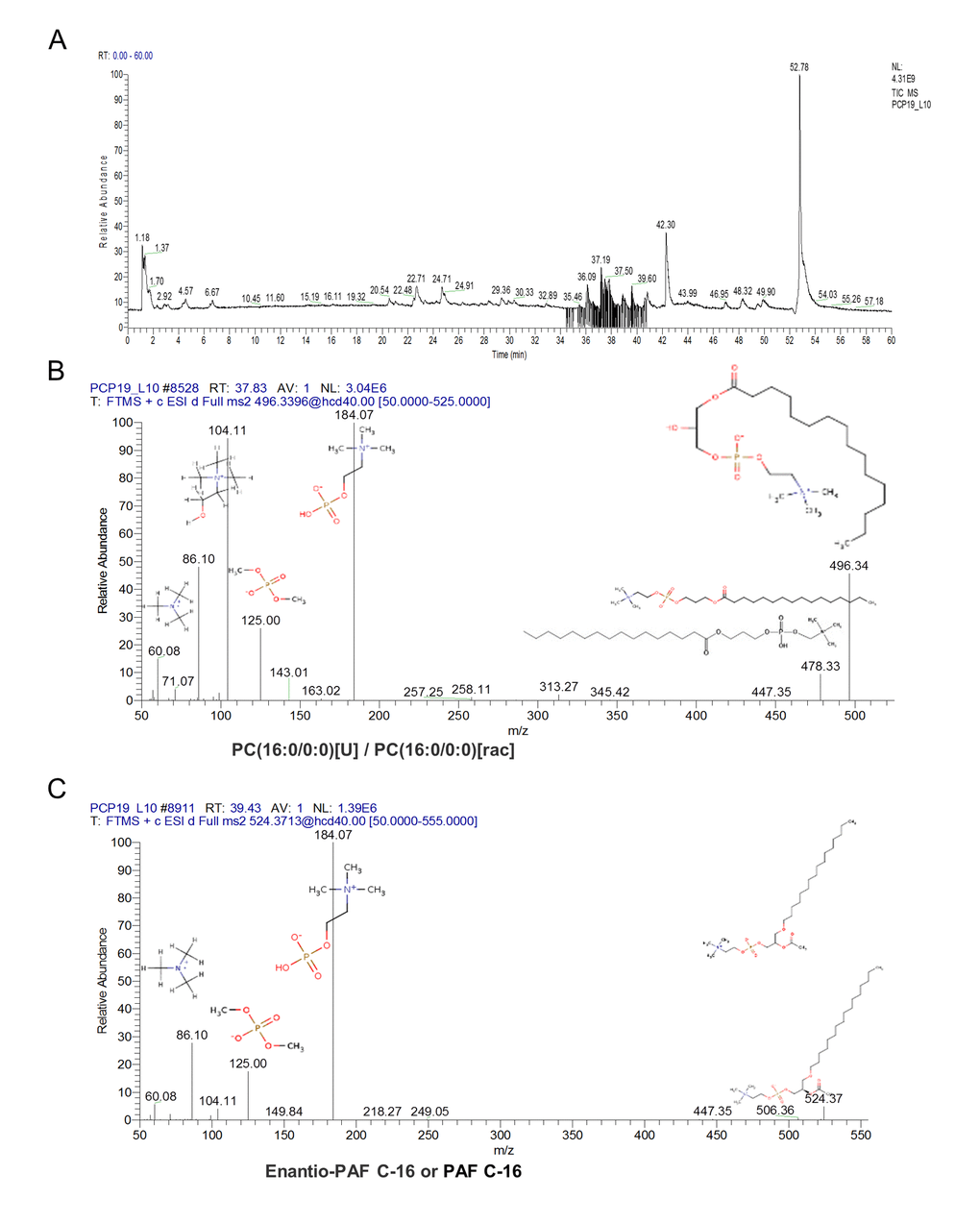 The characteristic of the altered content lyso phosphatidylcholine (LPC) and platelet-activating factor (PAF). Orbitrip coupled with HPLC detected altered content metabolites with the m/z = 496.3324 and 518.3168 that were continuously eluted in 34 - 41 minutes (A). The structure information obtained from Orbitrip showed m/z = 496.3324 is a kind of LPC (B), and m/z =518.3168 is a kind of PAF (C).
